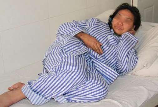 成都华西棕南医院精神分裂症